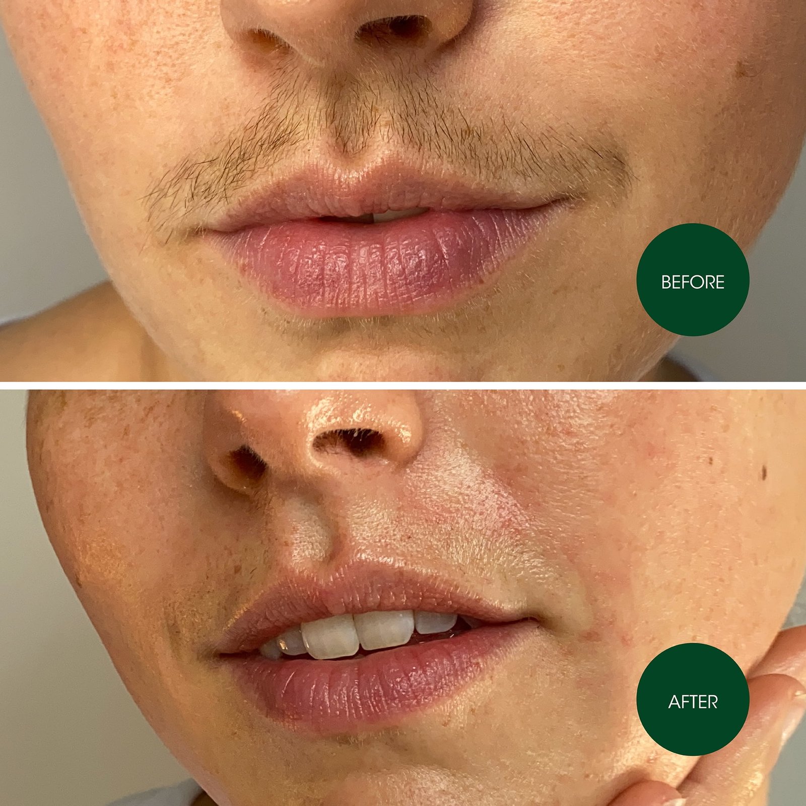 Nad's Facial Wax Strips 20 Pack for Women's Facial Hair Removal With 4 Calming Oil Wipes + Skin Protection Powder - High Quality Product Image