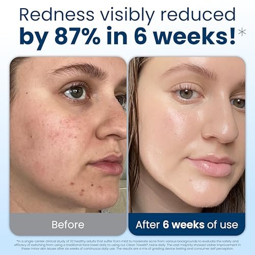 Clean Skin Club Clean Towels XL®, 100% USDA Biobased Face Towel, Disposable Face Towelette, Eczema Association Accepted, Makeup Remover Dry Wipes, Ult - Image 3